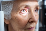 Glaucoma experts, Glaucoma experts, all about the eye disease glaucoma, Doctor