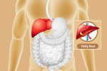 Fatty Liver news, Fatty Liver changes, dangers of fatty liver, Liver transplant