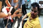 Madhav Chaudhary attack, Amity University attack, social media demands justice for two noida students who are brutally attacked, Feminism Madhav Chaudhary attack, Amity University attack, social media demands justice for two noida students who are brutally attacked, Feminism