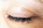 Eyelash Dandruff breaking, Eyelash Dandruff latest, all about eyelash dandruff, Annoying