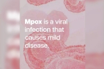 mpox in Africa, Mpox, mpox emergency again, Mortality