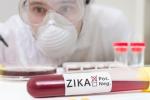 FDA, Zika Virus, fda expands zika screening to all us blood centers, West nile virus FDA, Zika Virus, fda expands zika screening to all us blood centers, West nile virus